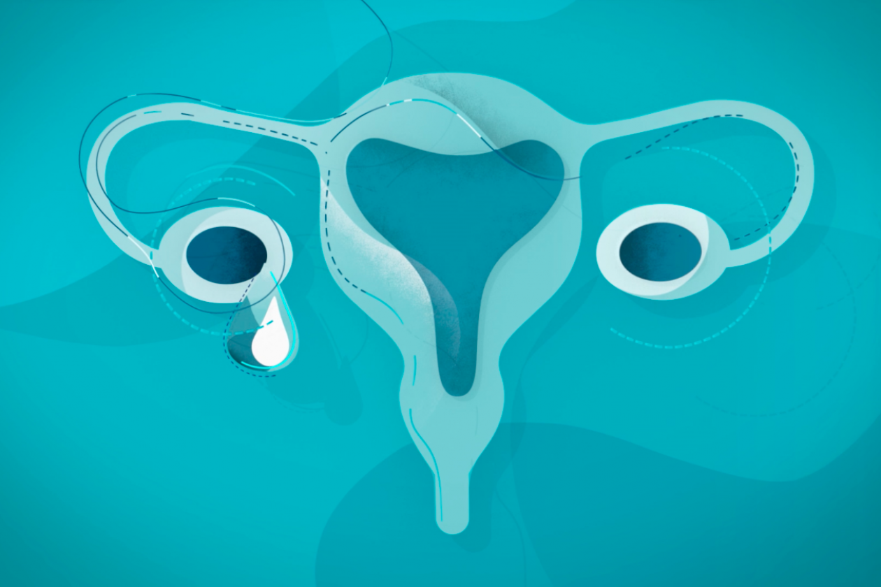 Ovarian Cancer Australia Says It S Time For Ovary Action B T